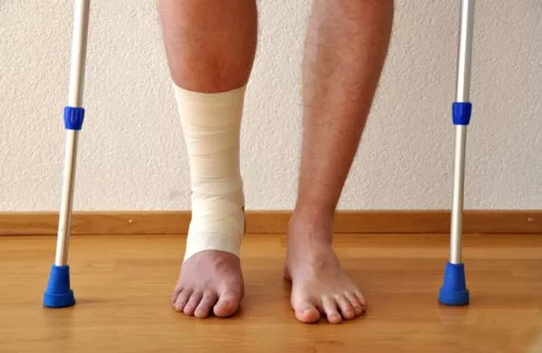 Common Ankle Injuries – XPhysiotherapy